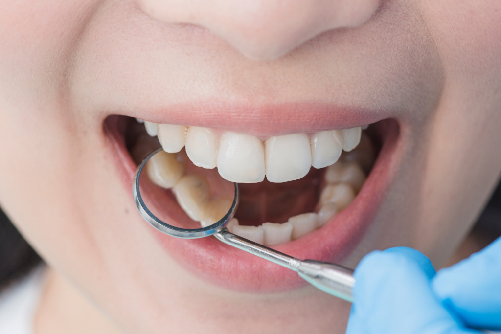 Importance of Regular Dental Check-up | Oral Health